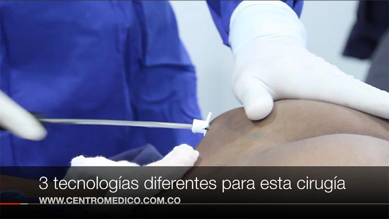 biopolimeros en gluteos sintomas