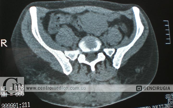 resonancia magnetica por biopolimeros