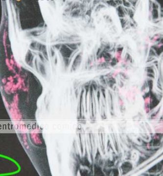 resonancia magnetica para biopolimeros en cali