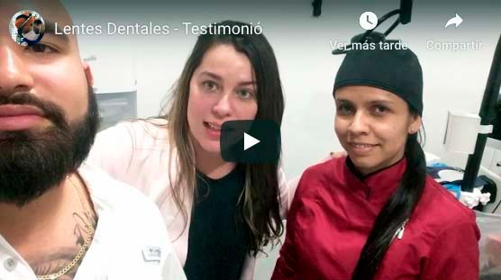 lentes dentales ceramicos antes y despues